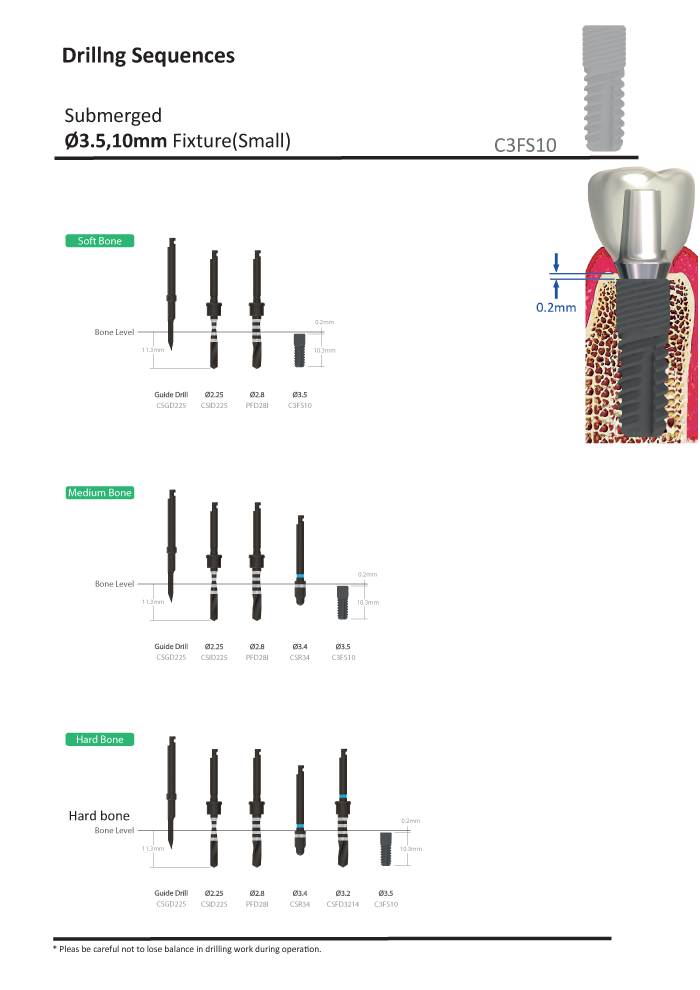 submerged implant unpacking process