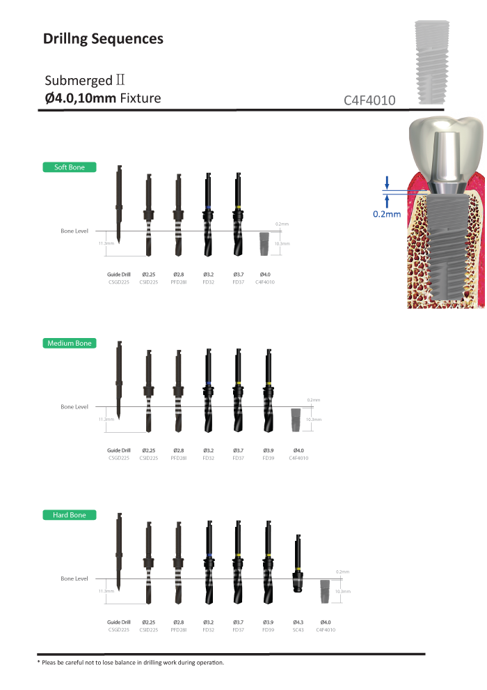 internal implant unpacking process