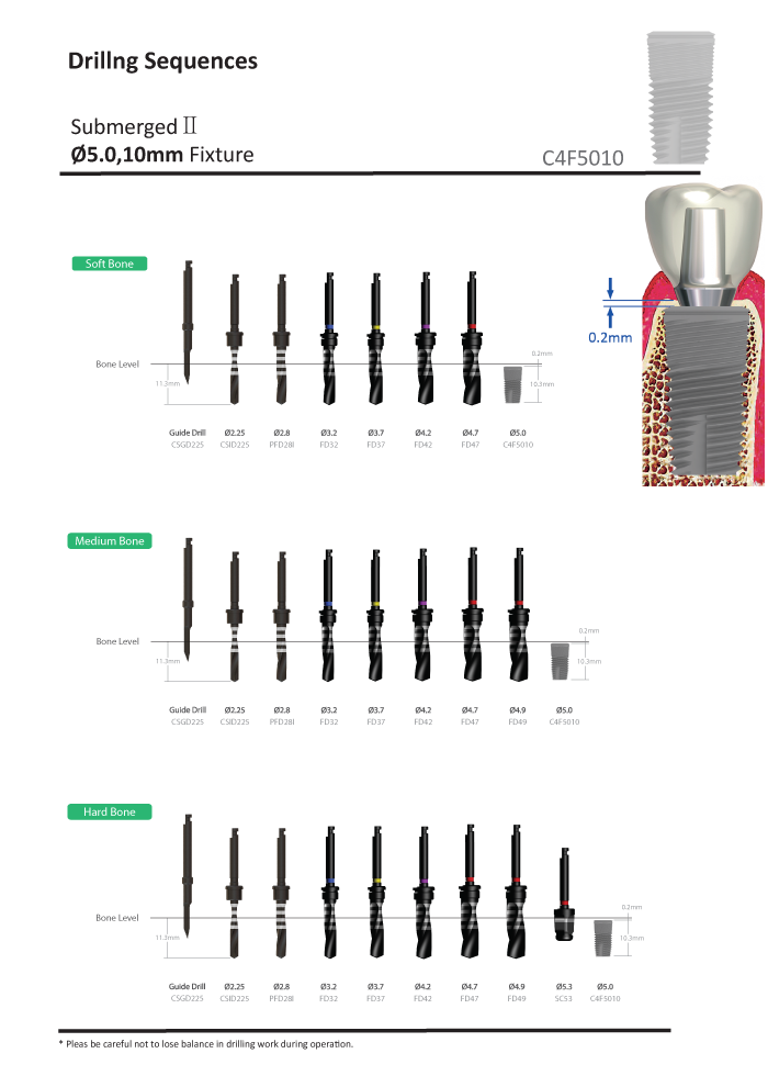 internal implant operation procedure